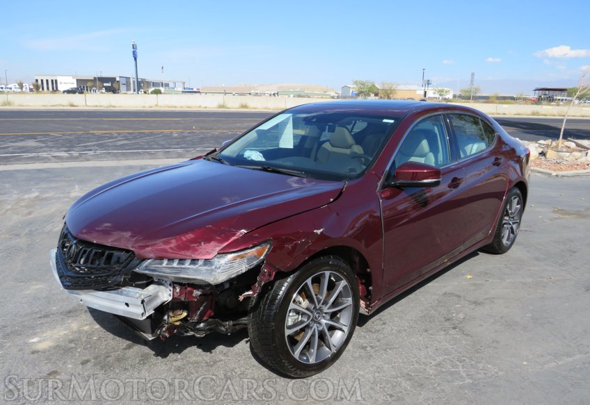 2015 Acura TLX - Image 4