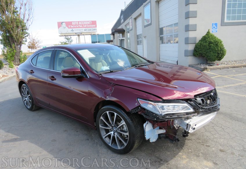 2015 Acura TLX - Image 3