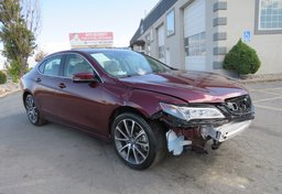 2015 Acura TLX - Image 1